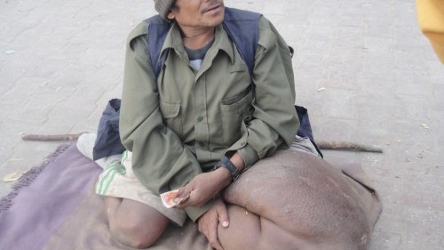 हात्तीपाइलेको जोखिम बढेपछि सर्लाहीमा विशेष औषधि अभियान