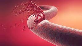 कञ्चनपुरमा २२३ जनामा सिकलसेल–थालसेमिया ट्रेट पहिचान