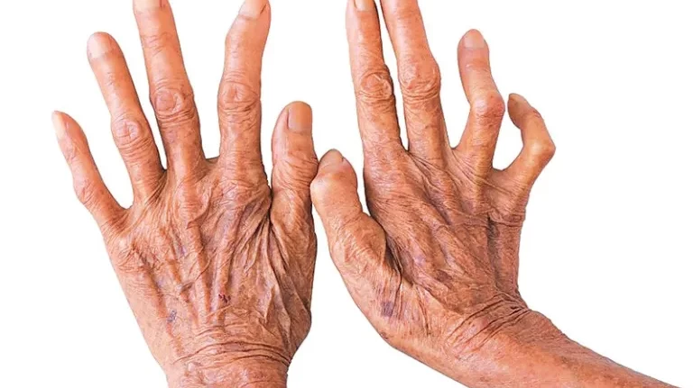 कण्ठरोगविरुद्ध नेपालको ऐतिहासिक जित