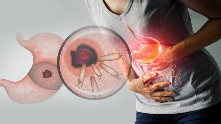 बारम्बार छाति पोल्छ ? पेटको क्यान्सरको प्रारम्भिक लक्षण हुन सक्छ