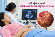 गर्भमा नै बच्चाको रगतको कमी उपचार, नेपालमा पहिलोपटक