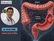 के कारणले हुन्छ ठूलो आन्द्राको क्यान्सर ? लक्षण र बच्ने उपाय