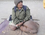 हात्तीपाइलेको जोखिम बढेपछि सर्लाहीमा विशेष औषधि अभियान