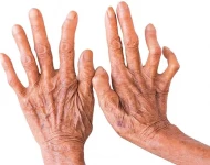 कण्ठरोगविरुद्ध नेपालको ऐतिहासिक जित