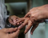 बाँकेको नरैनापुरमा ९ जना कुष्ठरोगी फेला, छालारोग महामारीको सङ्केत