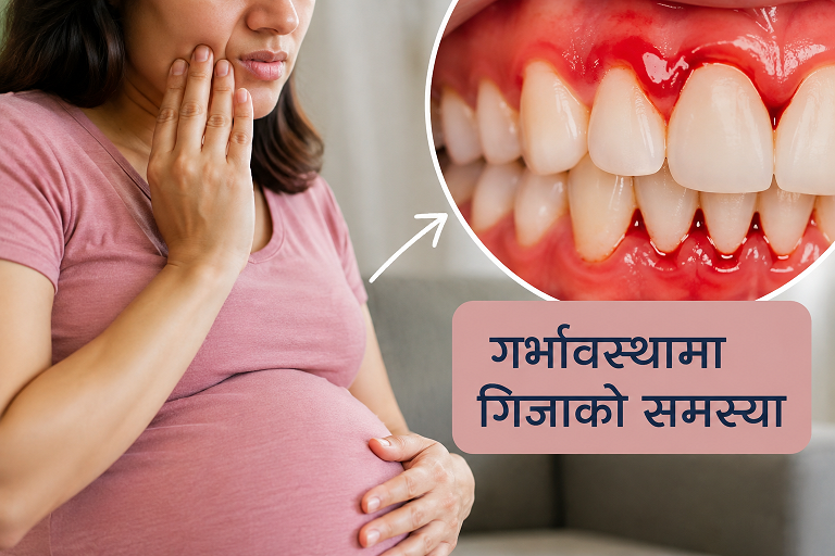 गर्भावस्थामा गिजाको समस्या : आमा र बच्चाको स्वास्थ्यमा कस्तो असर पर्छ?