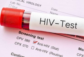 एचआईभी सङ्क्रमणलाई शरीरबाट हटाउन सकिने : वैज्ञानिकहरूको दाबी