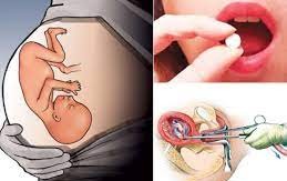 के गर्भपतनले नयाँ बच्चालाई असर गर्छ ?