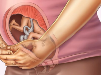 गर्भपतन पछि कुन समयको गर्भाधारण उपयुक्त ? 