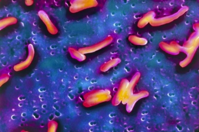 नाइजेरियामा हैजाको प्रकोप, कम्तीमा २० जनाको मृत्यु