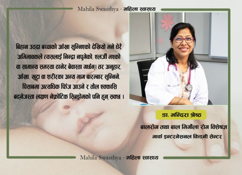 बिहान उठ्दा बच्चाको आँखा सुन्निएको छ ? यसको कारण र दीर्घकालीन असर