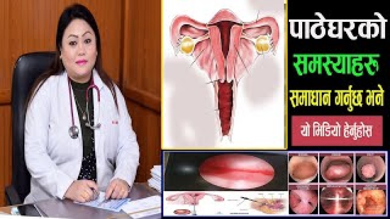 कसलाई हुनसक्छ पाठेघरमा ट्युमर ?