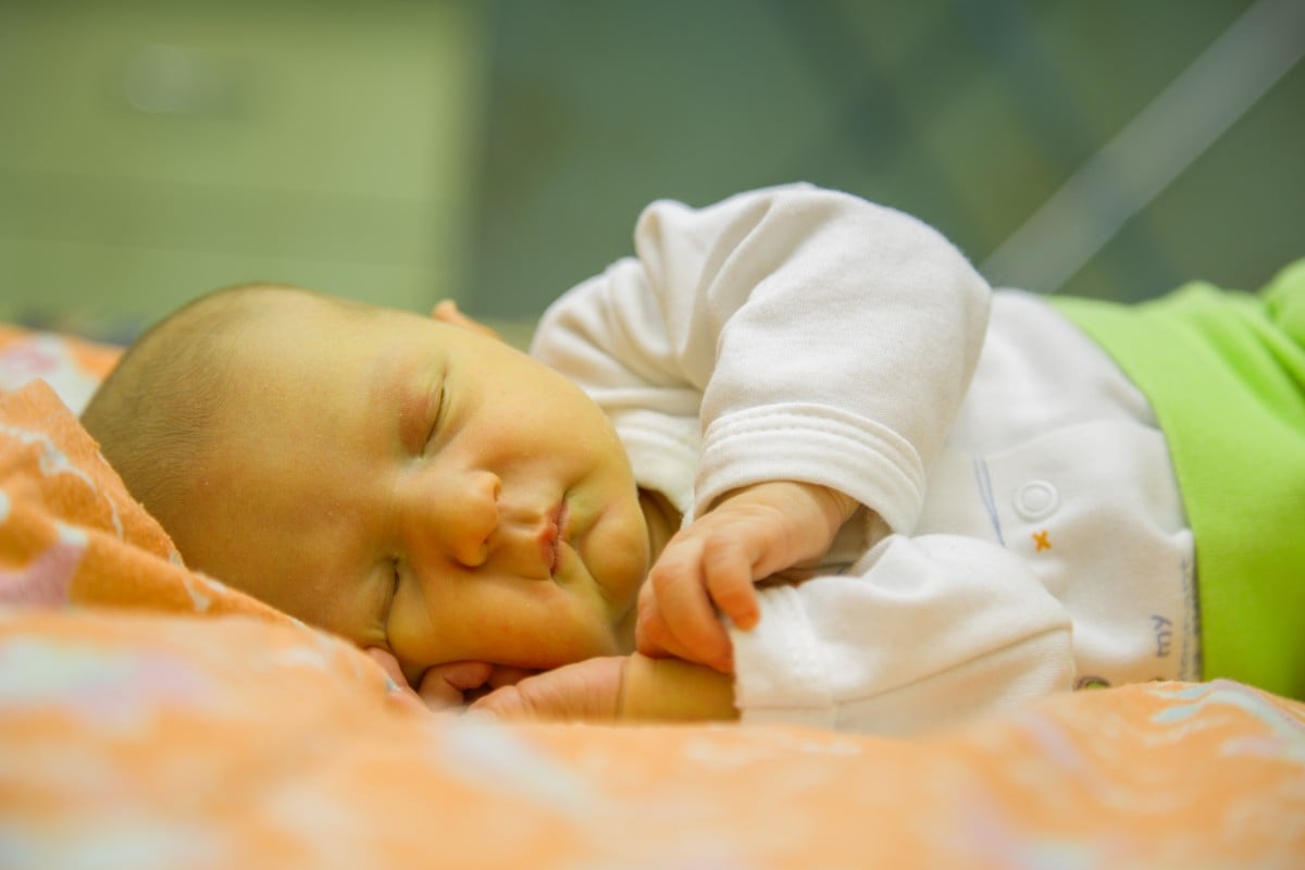 के जन्मिनासाथ शिशुमा जन्डिस हुनु सामान्य हो ?  लक्षण, रोकथाम र उपचार । ।